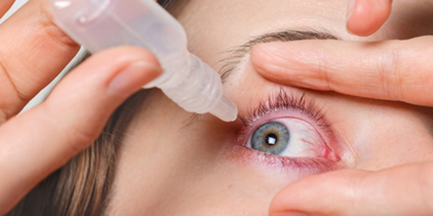 Sequedad ocular, irritación, ojos rojos. Causas y tratamiento