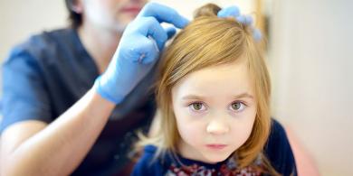 Eliminar con éxito piojos, pulgas y garrapatas con Aceite de árbol de té