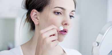 Herpes simple. Qué es y como se puede tratar.
