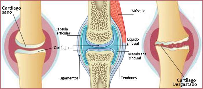 Diferencia entre tendones y ligamentos
