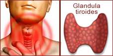 glándula tiroidea
